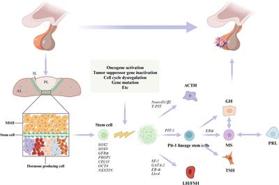 Pathogenesis, clinical features, and treatment of plurihormonal pituitary adenoma